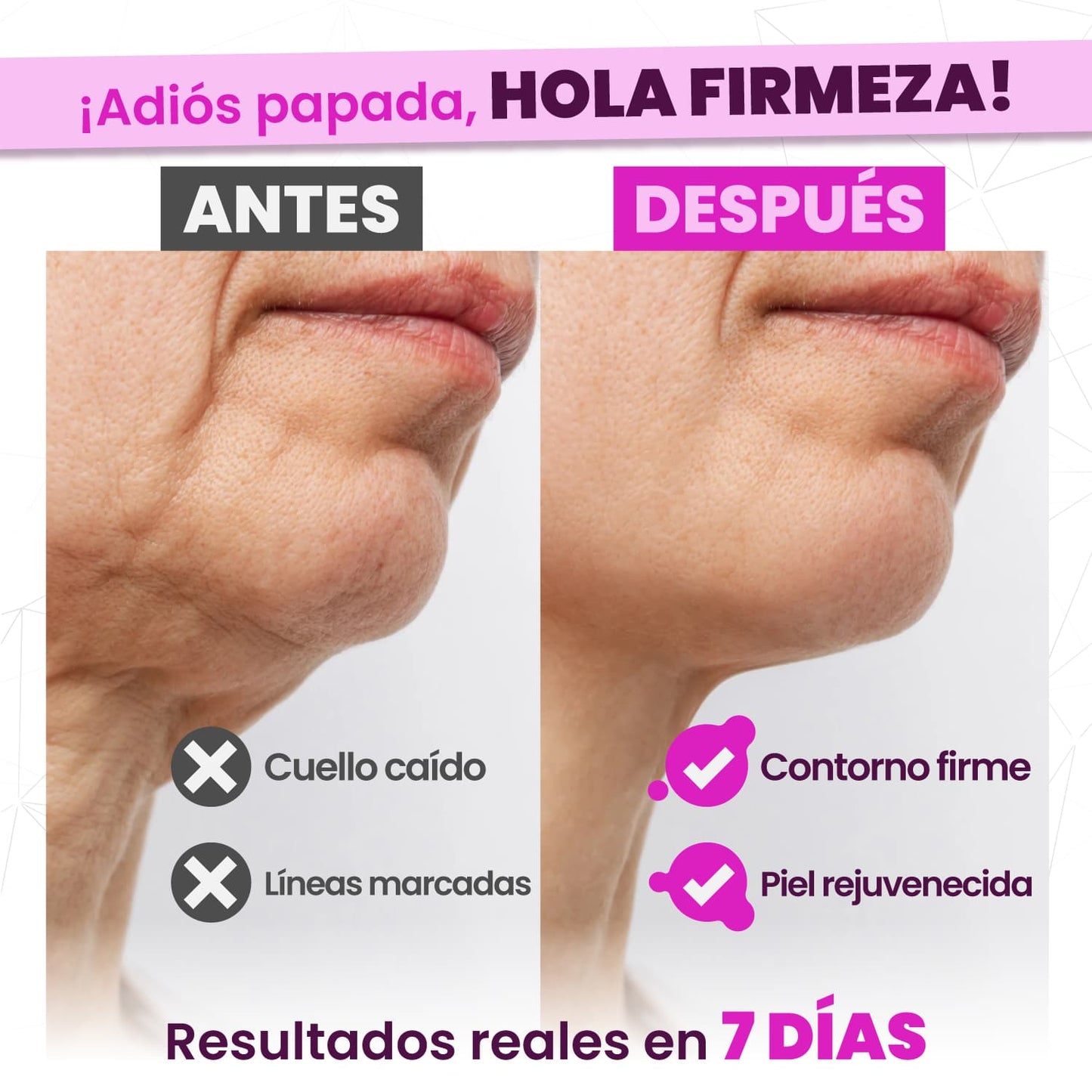 NockPon - Crema para el Cuello - OFERTA 2X1
