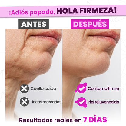 NockPon - Crema para el Cuello - OFERTA 2X1
